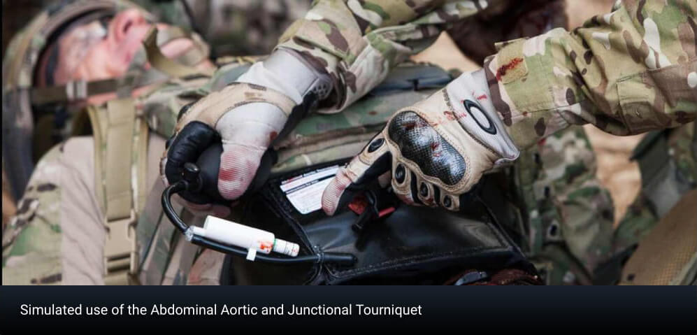 Aortic complications